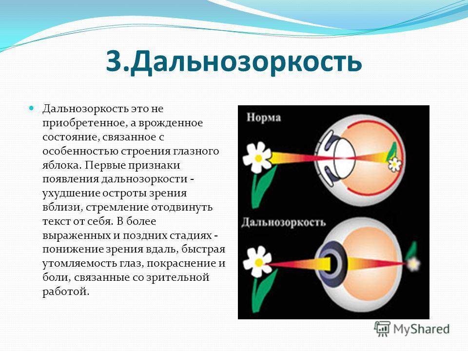 Причина дальнозоркости изображение формируется