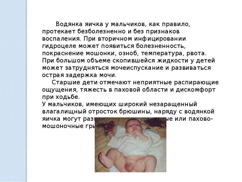 Водянка яичка * клиника диана в санкт-петербурге