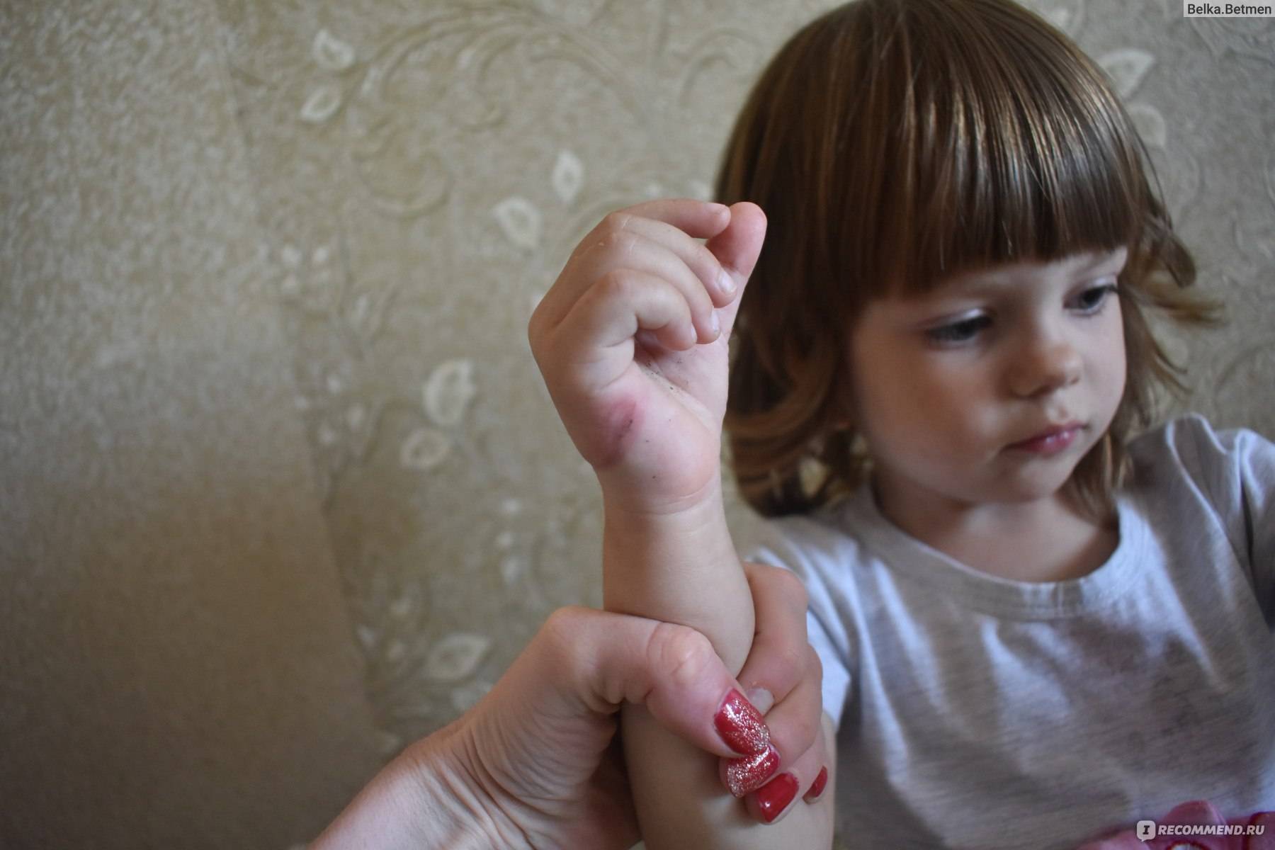 Как отучить ребенка сосать палец | до двух лет, до пяти лет, школьника