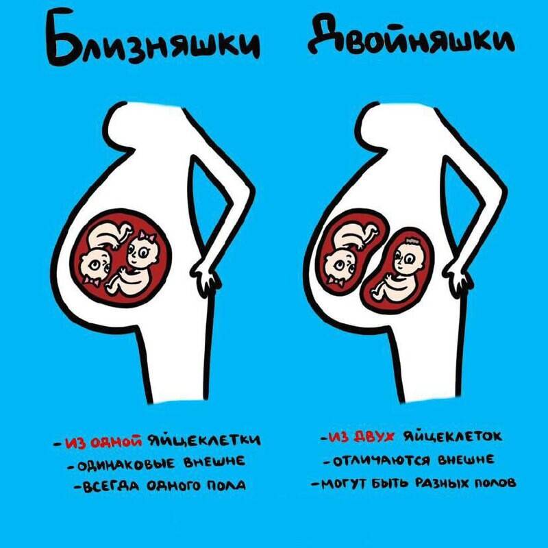 Чем отличаются близнецы от двойняшек