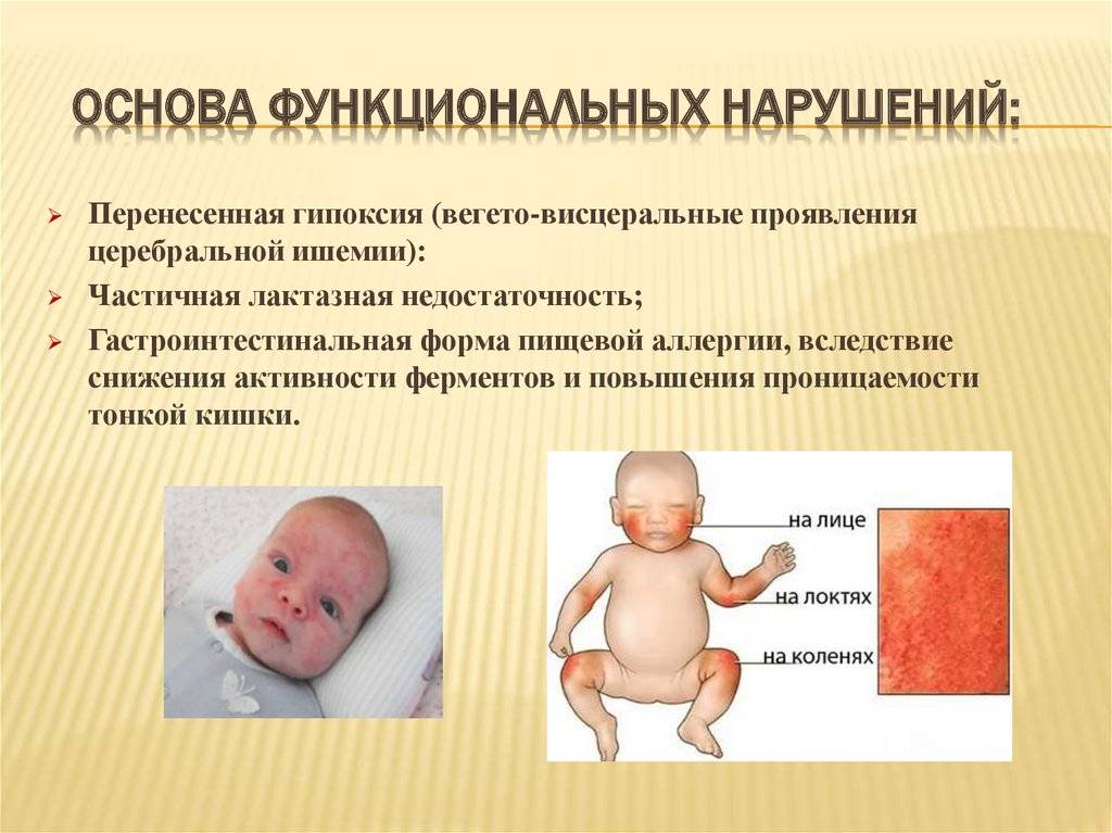 Кожные заболевания у детей (фото): описание, лечение и профилактика