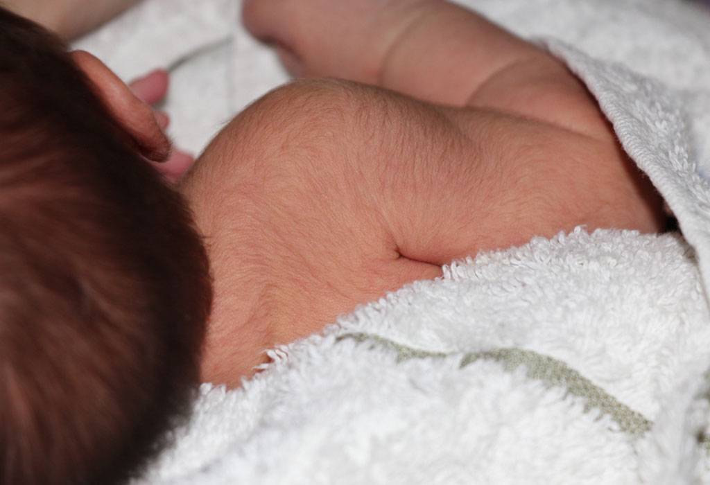 Щетина у новорожденных или кочерга: фото на ушах, спине, теле