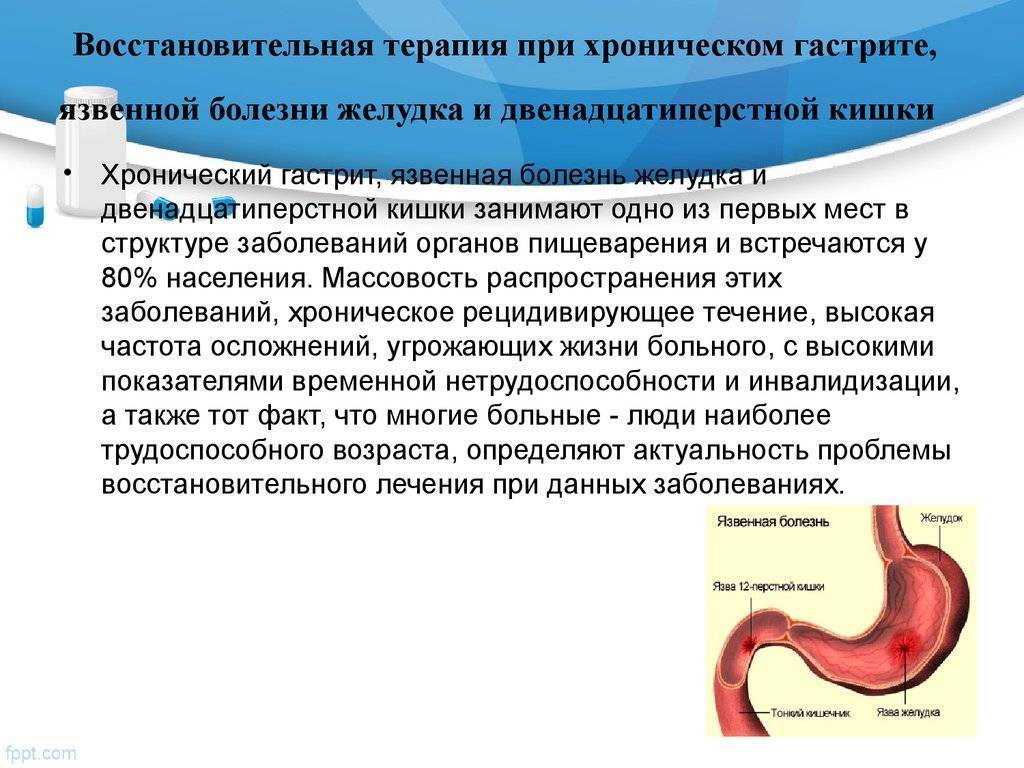 Клиническая картина язвенной болезни