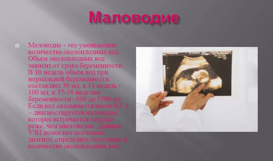 Причины и последствия маловодия при беременности