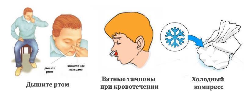 Травмы носа у детей - симптомы болезни, профилактика и лечение травм носа у детей, причины заболевания и его диагностика на eurolab