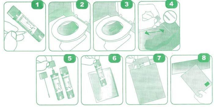 Копрограмма у грудничка как сдавать при запорах