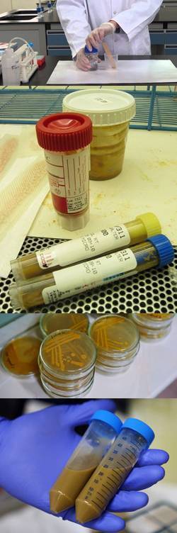 Копрограмма (общий анализ кала) - расшифровка, нормальные значения. как правильно подготовится и собрать материал?