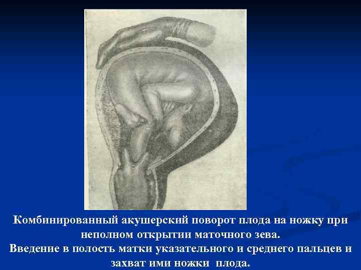 Санкт-петербургское государственное бюджетное учреждение здравоохранения «родильный дом №17»