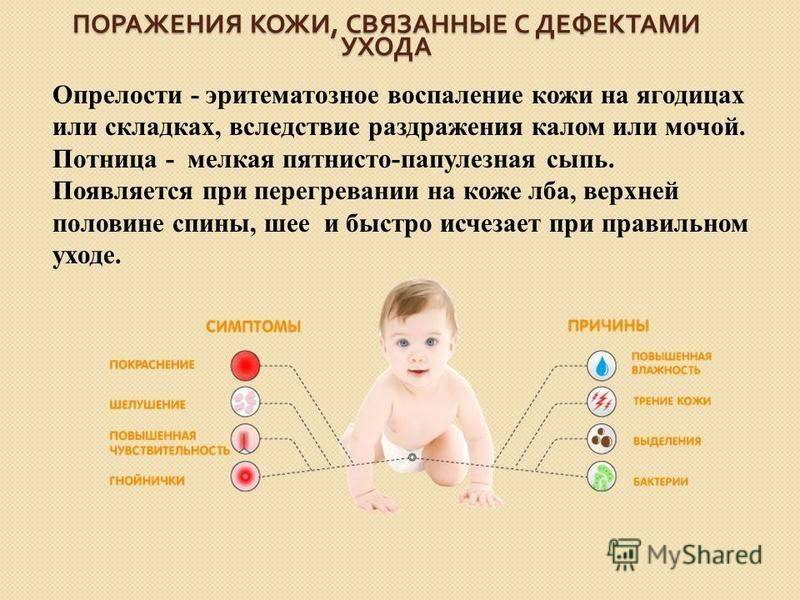 Чем лечить потницу у грудничка или младенца