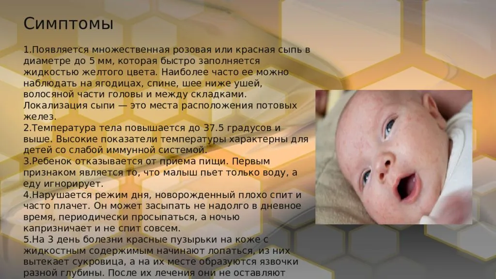 Пузырчатка - квд №2