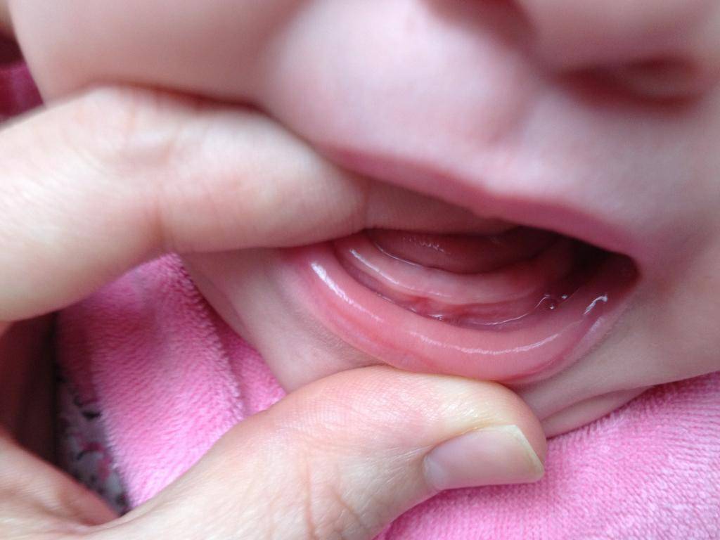 Что такое детские глазные зубы, симптомы и особенности прорезывания.