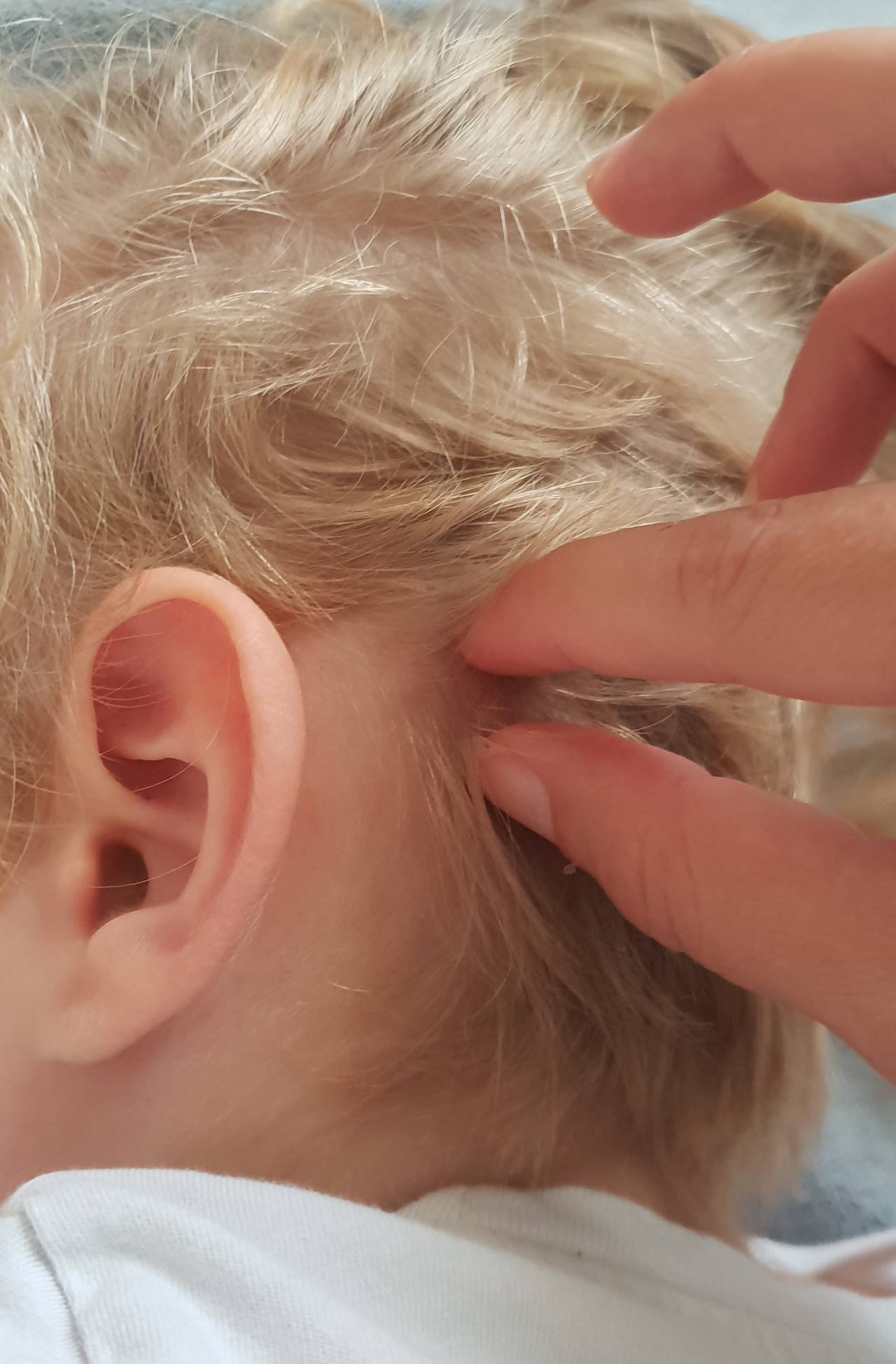 Причины и лечение шишки за ухом у ребёнка - medboli.ru