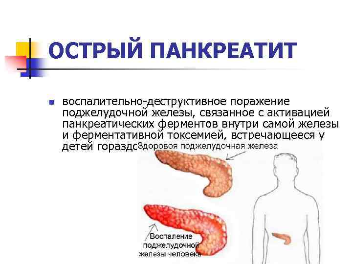 Презентация острый панкреатит у детей