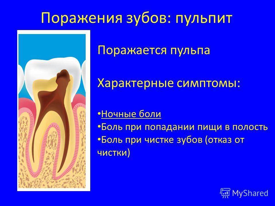 Пульпит молочного зуба – что это такое и как лечат детский пульпит