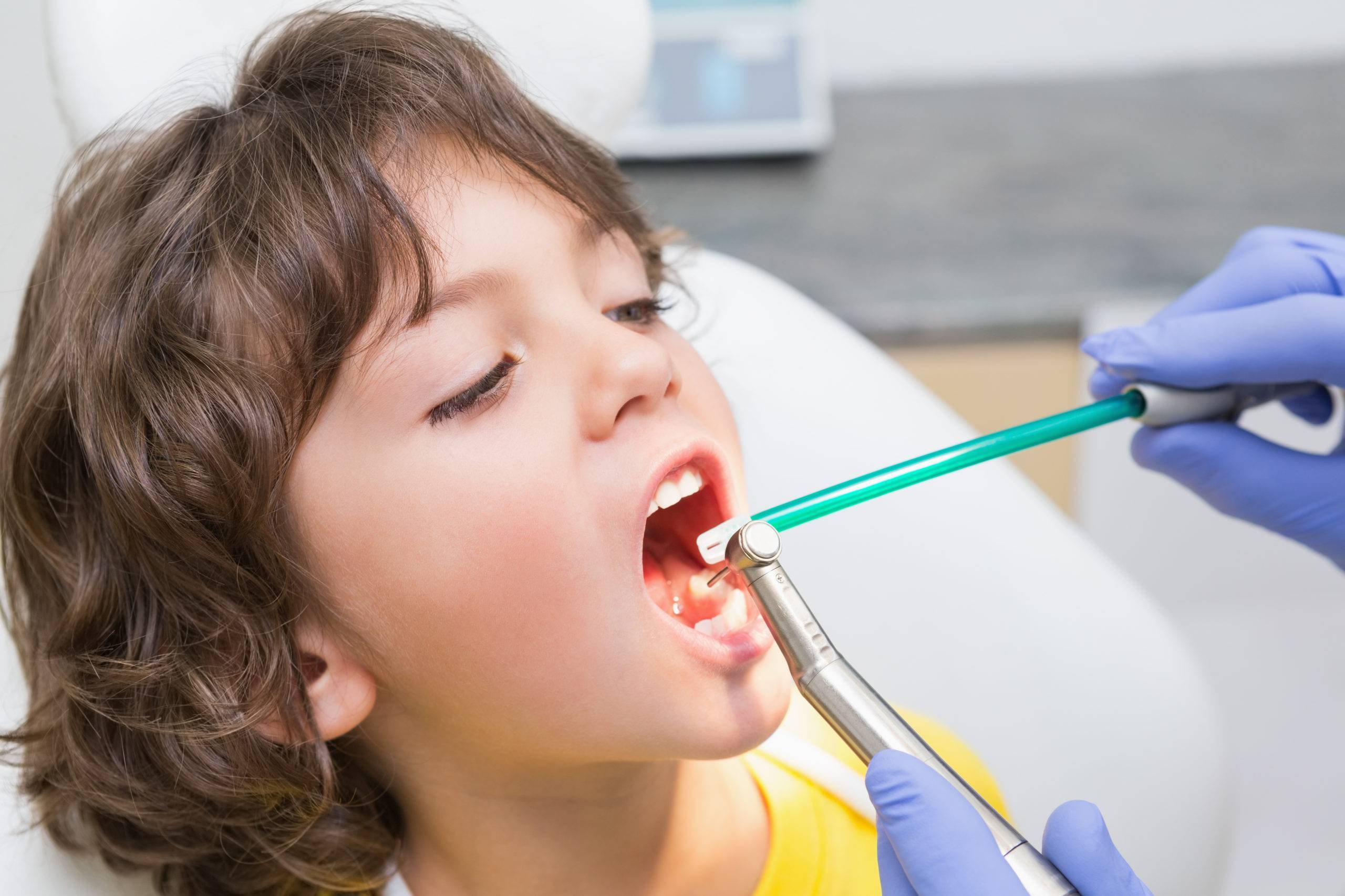 Молочные зубы – лечить или удалять?