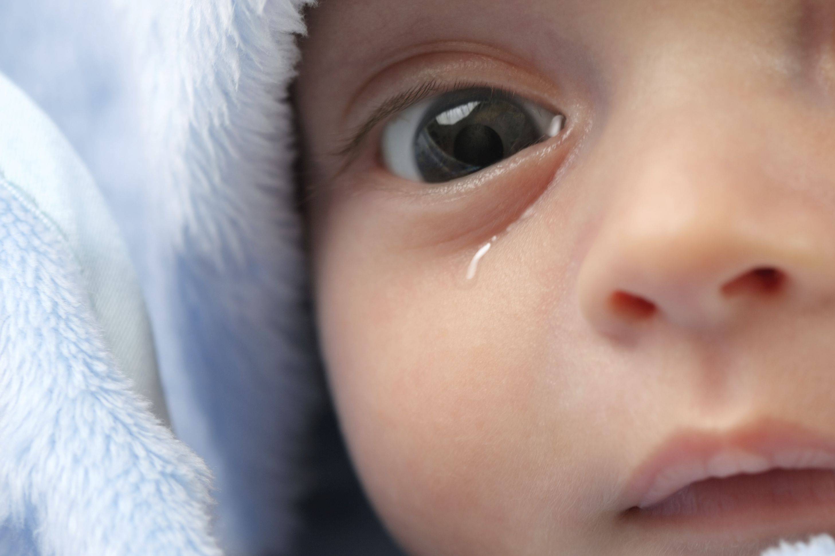 Болят глаза – симптомы, причины, лечение. что делать, когда болят глаза у ребенка?
