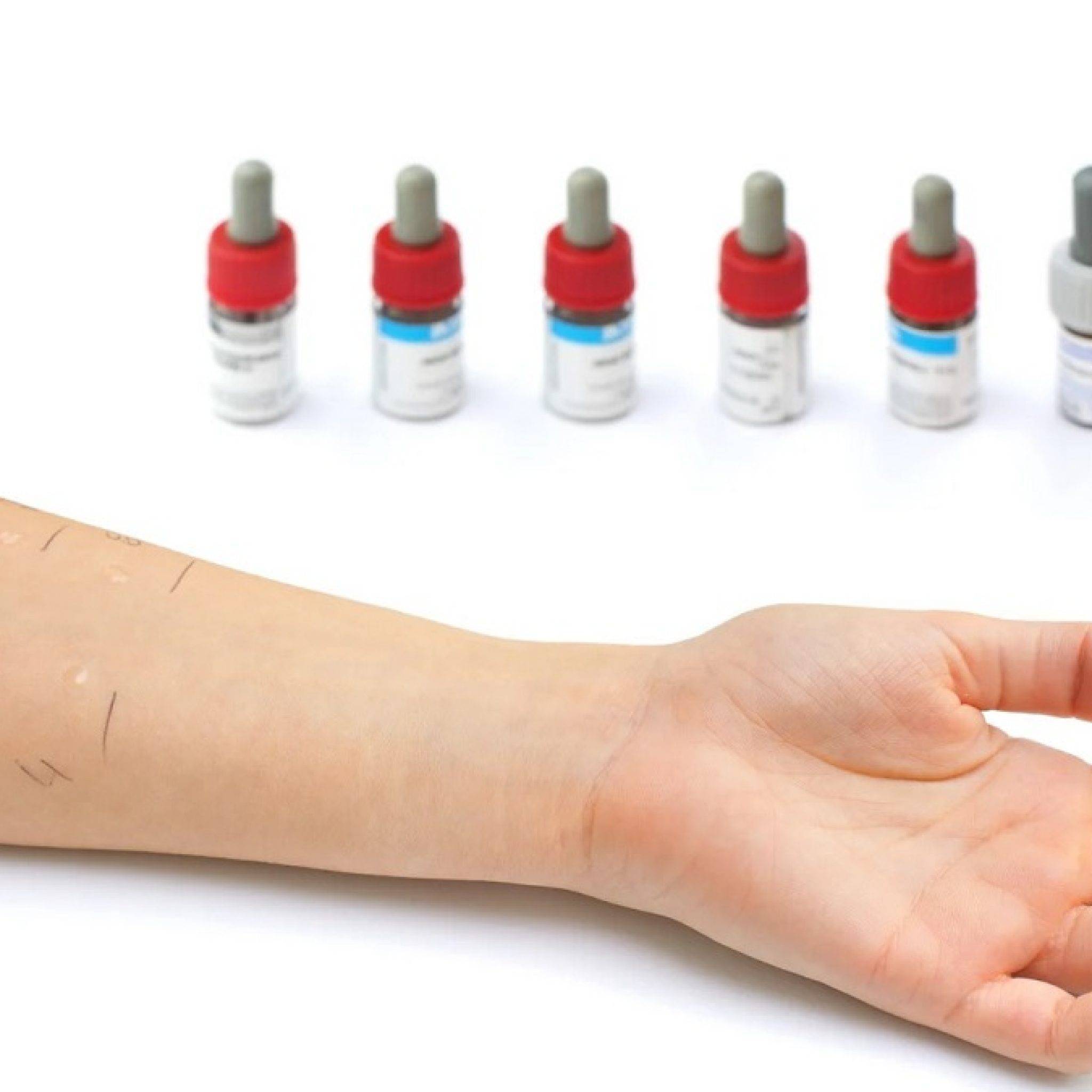 Кожные пробы на аллергены: как правильно сделать тесты и исследование крови