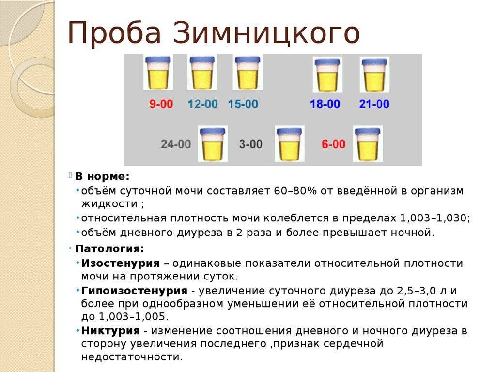 Анализ мочи по зимницкому: как собирать, норма, расшифровка | азбука здоровья