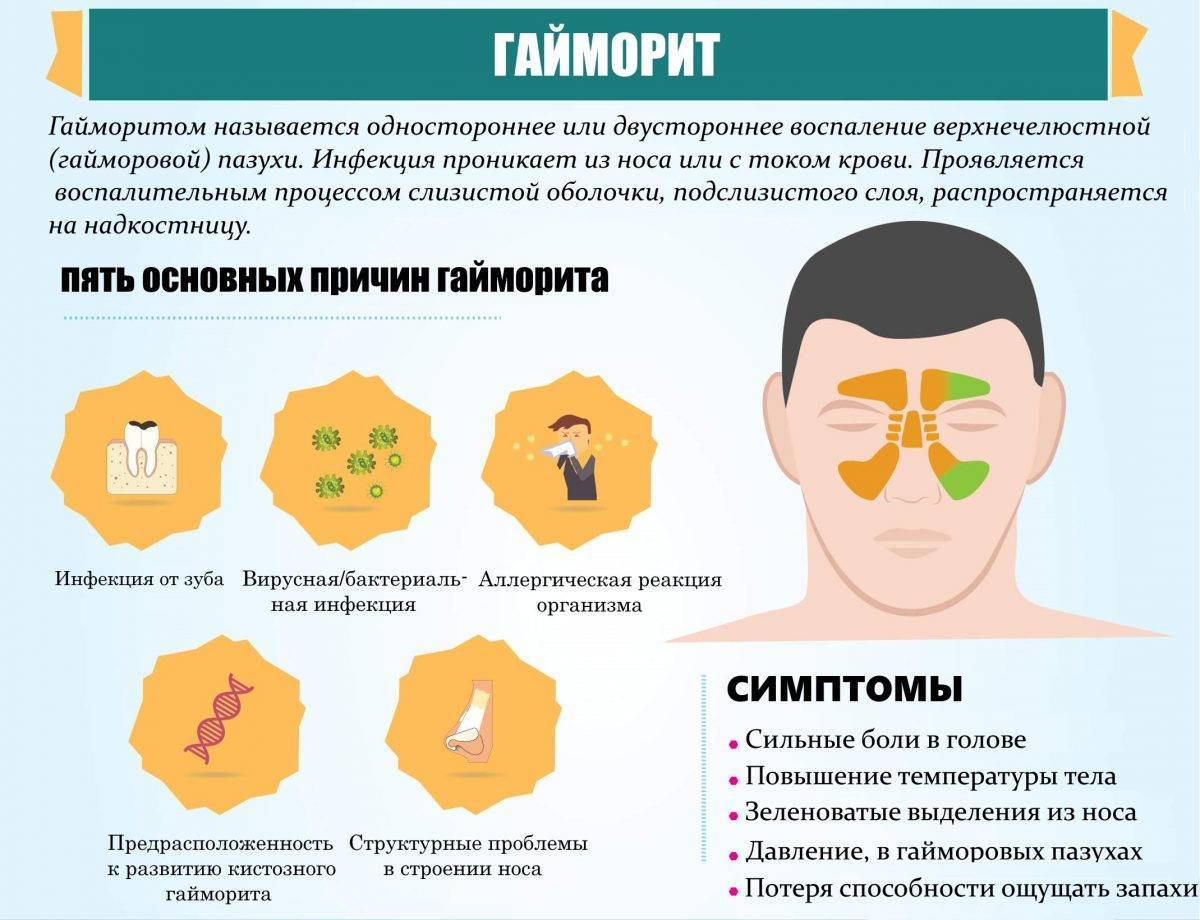 Синусит у ребенка: симптомы и лечение, признаки острого, гнойного, аллергического, хронического синусита у детей