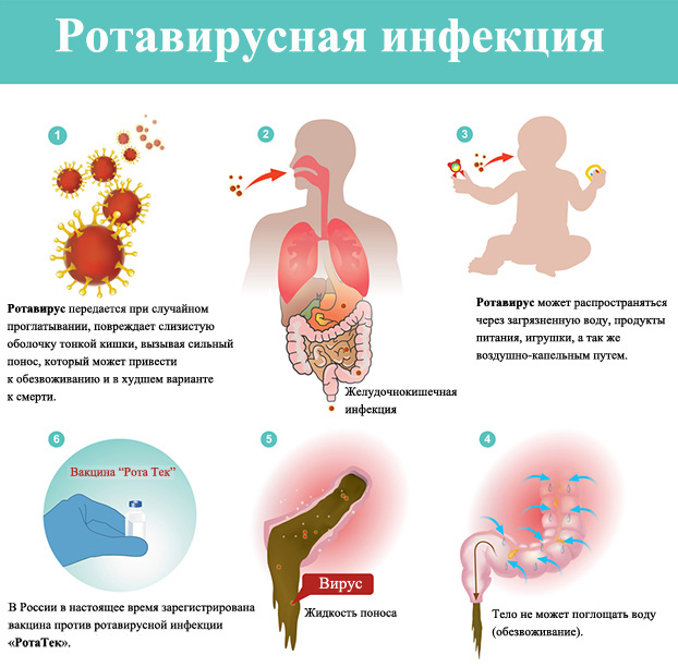 Ротавирус - симптомы, лечение и профилактика