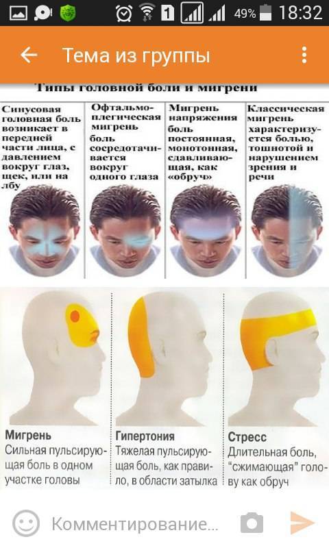 Картинки боли головы виды