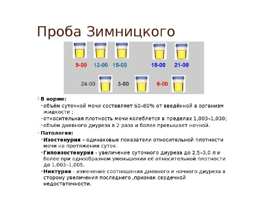 Сбор мочи по зимницкому картинки