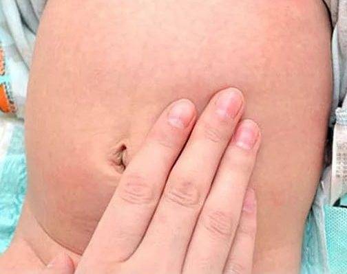 Какие кожные заболевания возникают во время беременности и чем их лечить