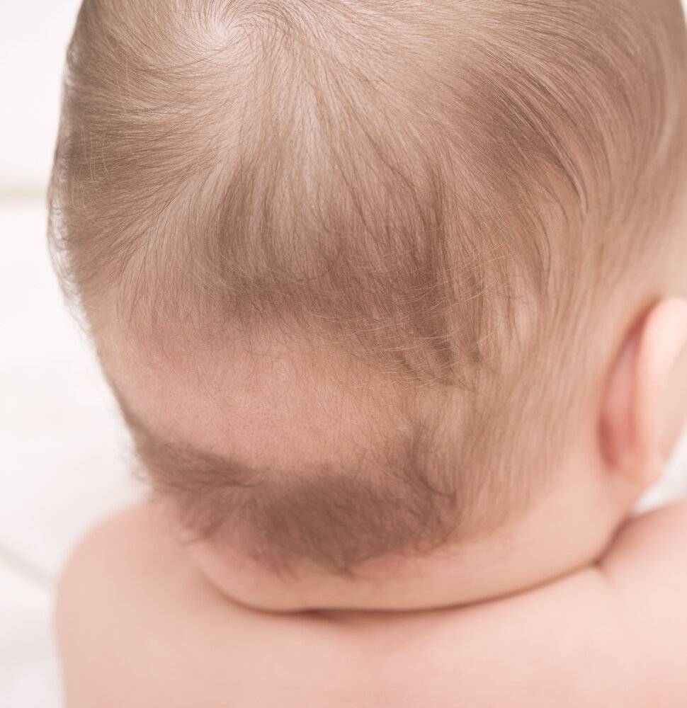 Почему у новорожденного нет волос на передней части головы