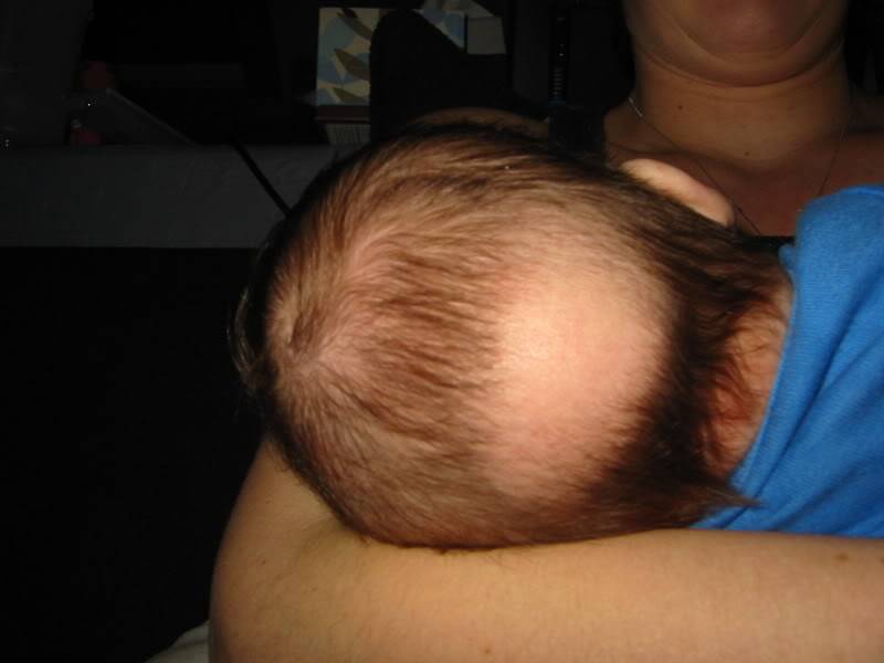 Почему у ребенка растут волосы на шее