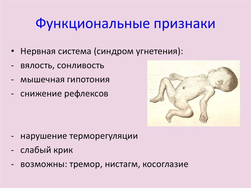 Нарушение мышечного тонуса у детей первого года жизни - гбуз новосергиевская районная больница