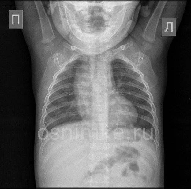 Опасен ли рентген — блог медицинского центра он клиник