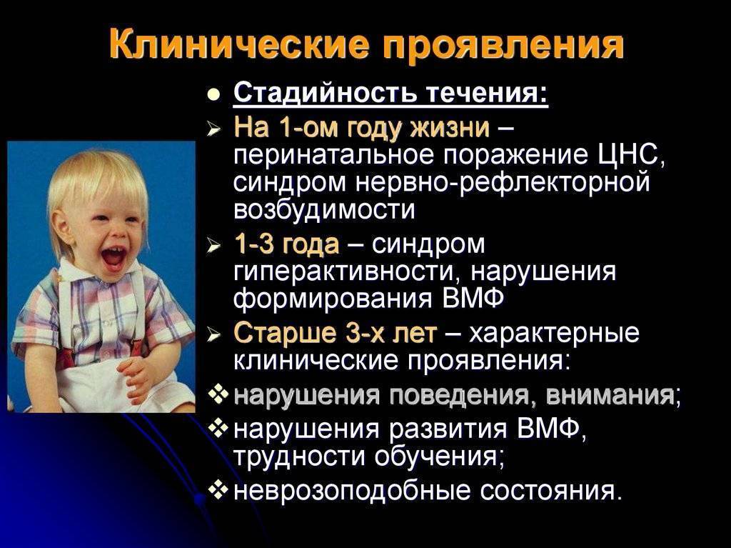 Энцефалопатия у детей (перинатальная): симптомы, лечение, прогноз и последствия