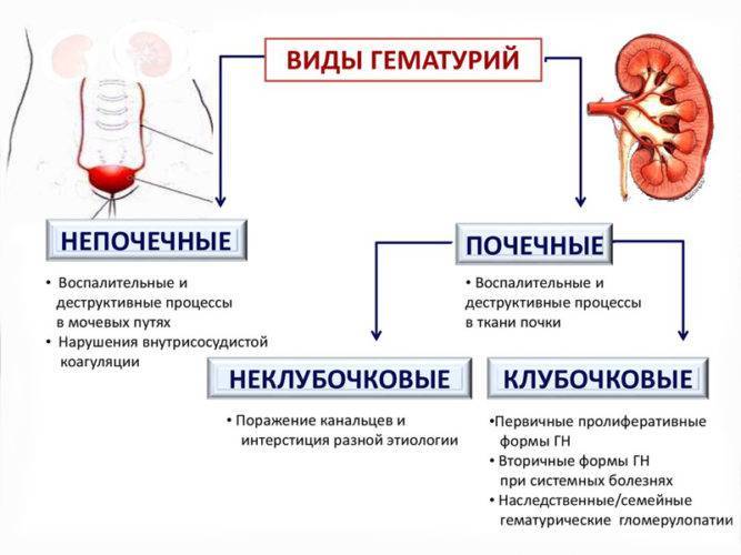 Причины появления крови в моче