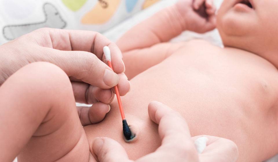 Почему мокнет пупок у новорождённого: причины и как помочь крохе