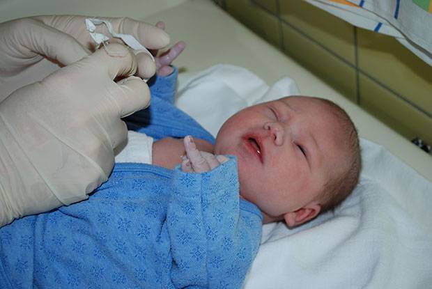 Зондирование слезного канала у новорожденных и детей до года: видео, последствия операции