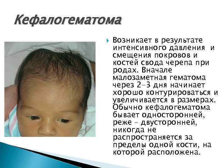 Гематома на голове у новорожденного ребенка после родов