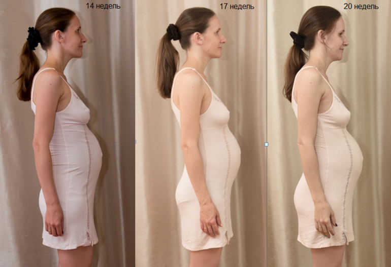 Внематочная беременность на ранних сроках: признаки, симптомы, признаки, сроки - women first