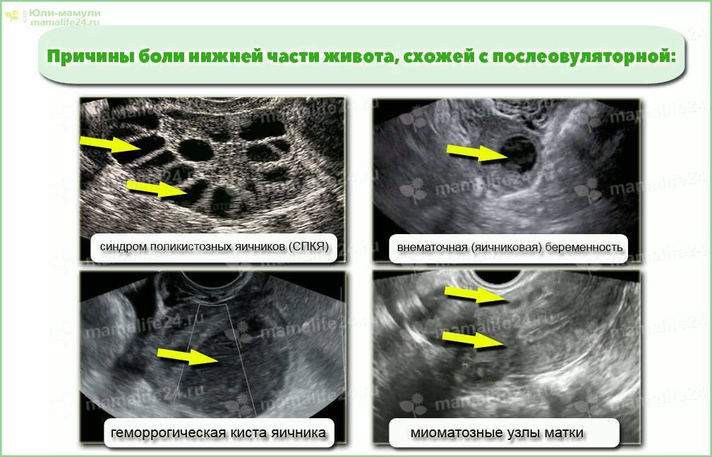 Боль внизу живота у женщин слева, справа: причины, диагностика, лечение в киеве