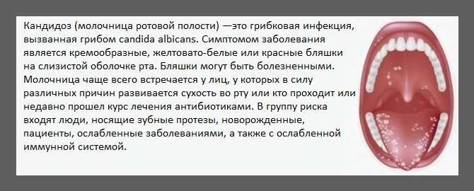 Воспаление слизистой оболочки полости рта: причины и лечение