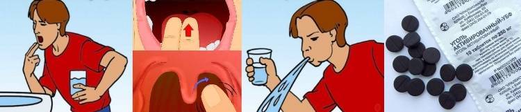 Как легко вызвать рвоту. Отравление через рот. При отравлении через рот:. Промывание пострадавшему желудка.