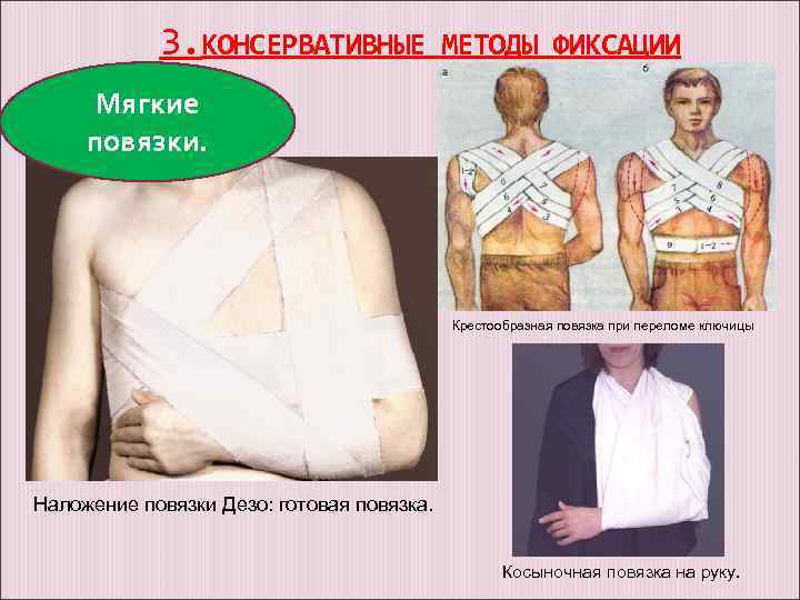 Нарушение заживления переломов костей | eurolab | травматология