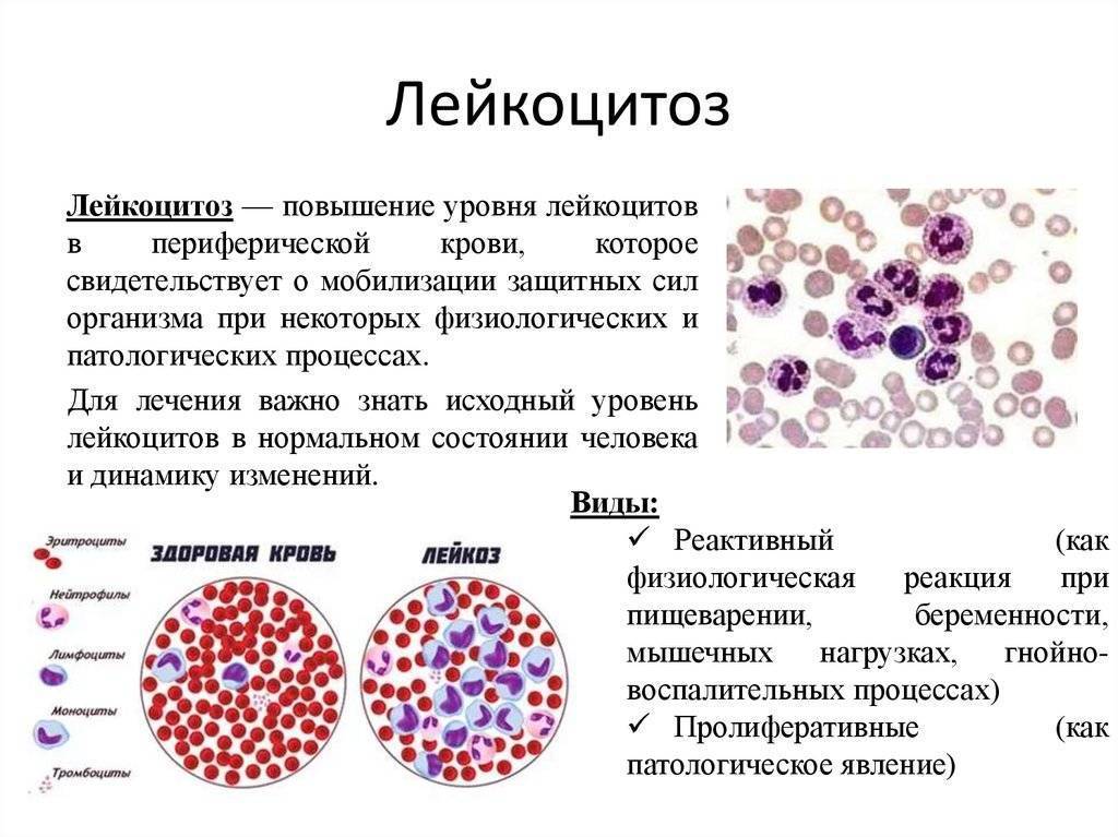 Лейкоциты в крови: норма, причины отклонений, что значат