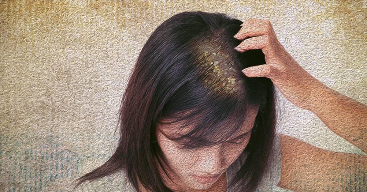 Могут ли выпадать волосы из за депрессии с белым кончиком