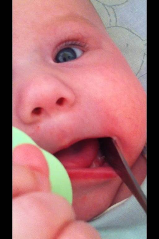 Как начинались зубки у детей? 3,5 месяца, кулаки в рот, сосет с причмокиванием и обильными слюнями. это зубы?