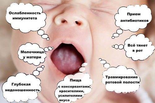 Причины пятен на языке у ребенка