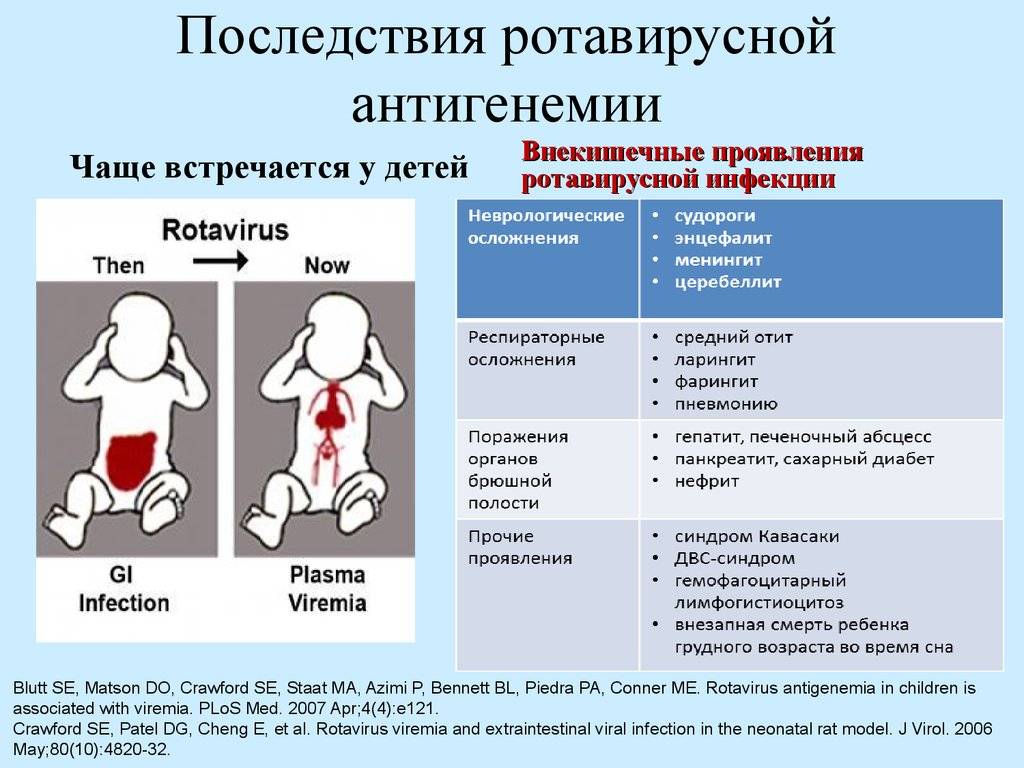 Ротавирусная инфекция