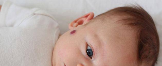 Покраснения на коже у ребенка: причины и что с этим делать