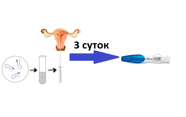 ᐈ перенос эмбрионов в полость матки (iv этап программы эко) в клинике репродукции iclinic в спб