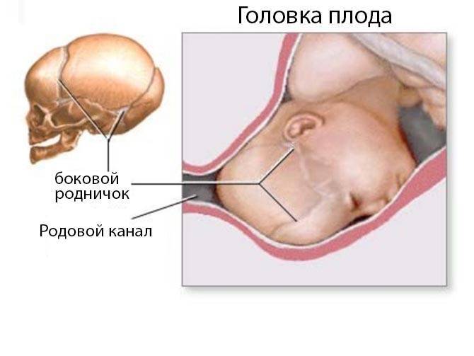 Когда зарастает родничок у ребенка: нормы и отклонения, что влияет на сроки