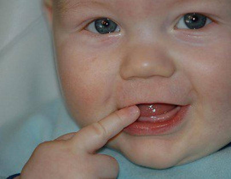 Киста зуба: симптомы, диагностика, лечение